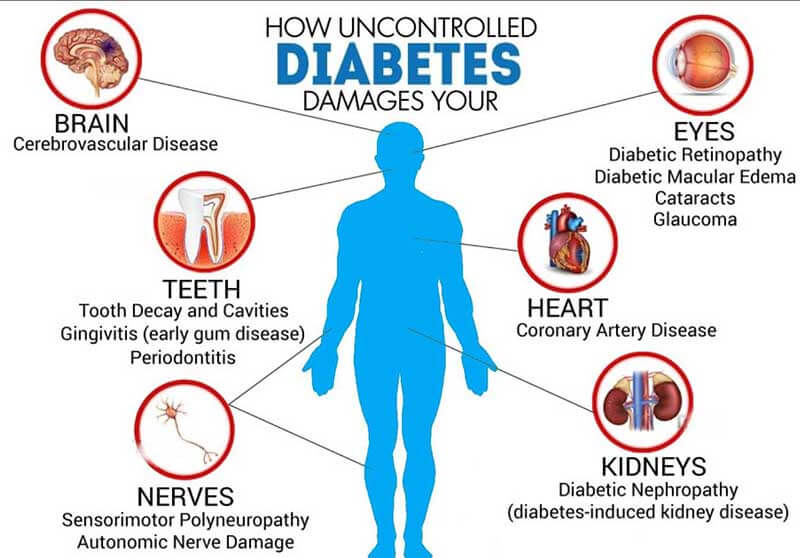عوارض خطرناک دیابت, خطر عوارض دیابت, عوارض دیابت, دانستنی های عوارض دیابت, تاثیر عوارض دیابت بر بدن, complications of diabetes