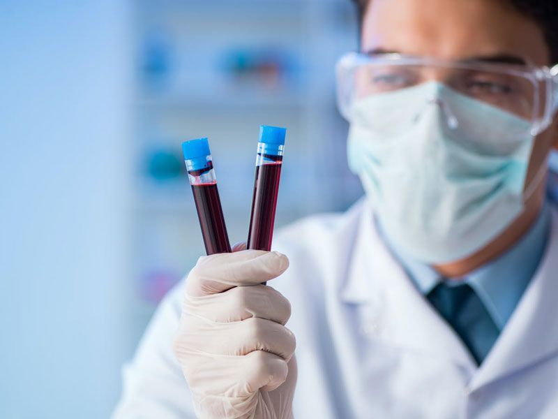 نحوه انجام آزمایش خون کرونا, علائم ویروس کرونا, دقت آزمایش خون کرونا