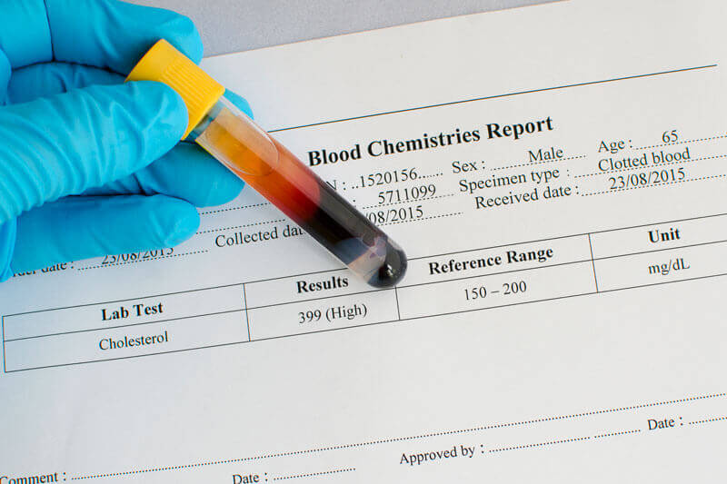 تشخیص کلسترول خون بالا