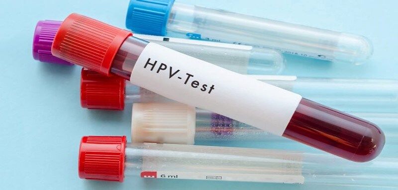 آزمایش اچ پی وی چگونه است