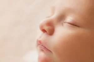 گرفتگی بینی در نوزاد