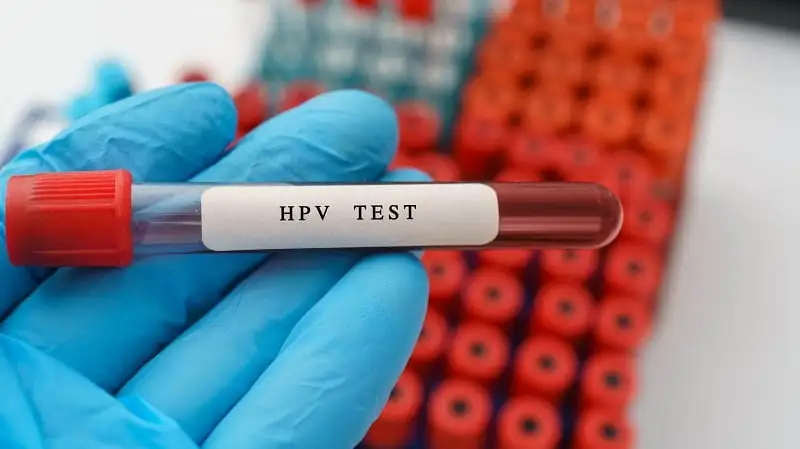 نحوه‌ی انجام آزمایش hpv