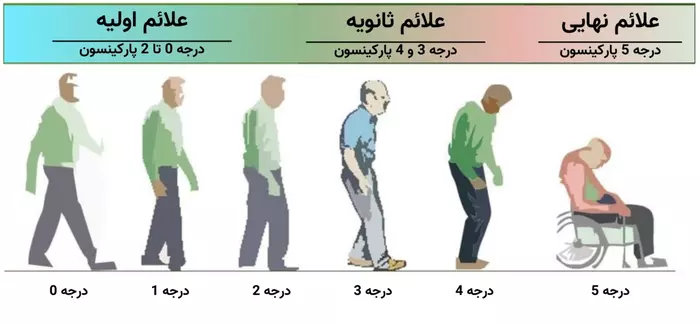 شدت بیماری پارکینسون