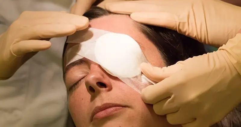 قرار دادن محافظ چشم بعد از جراحی آب مروارید