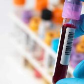 asanism-medical-lab انجام امور آزمایش در منزل توسط بهترین آزمایشگاه ها - آزمایش خون در منزل